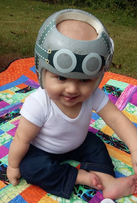 baby sticking out tongue, wearing a gray cranial orthosis in the style of a vintage pilot helmet